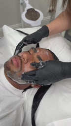 Blemish Control AHA 20%